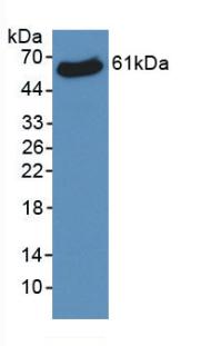 Monoclonal Antibody to Voltage Dependent Anion Channel Protein 1 (VDAC1)