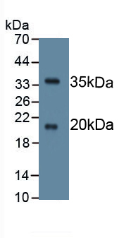 Monoclonal Antibody to Serine Peptidase Inhibitor Kazal Type 5 (SPINK5)