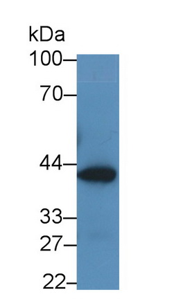 Monoclonal Antibody to Glutaminyl Peptide Cyclotransferase (QPCT)