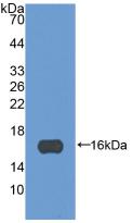 Monoclonal Antibody to Periostin (POSTN)