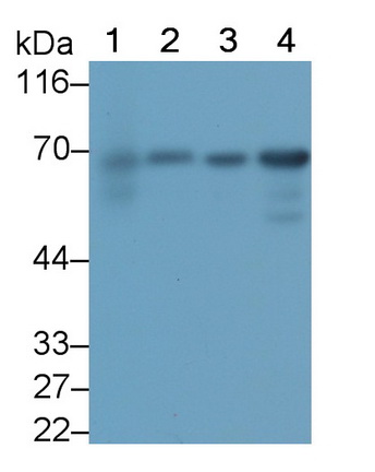 Monoclonal Antibody to Plastin 3 (PLS3)