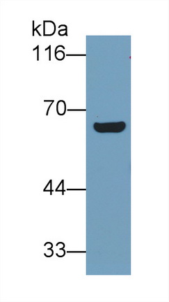 Monoclonal Antibody to Plastin 3 (PLS3)