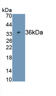 Monoclonal Antibody to Mesothelin (MSLN)