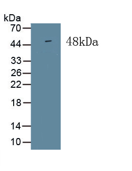 Monoclonal Antibody to Immunoglobulin Superfamily Containing Leucine Rich Repeat Protein (ISLR)