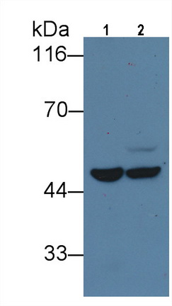 Monoclonal Antibody to Isocitrate Dehydrogenase 1, Soluble (IDH1)