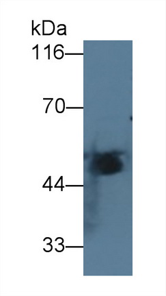 Monoclonal Antibody to Isocitrate Dehydrogenase 1, Soluble (IDH1)