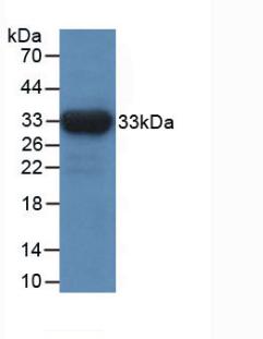 Monoclonal Antibody to Isocitrate Dehydrogenase 1, Soluble (IDH1)