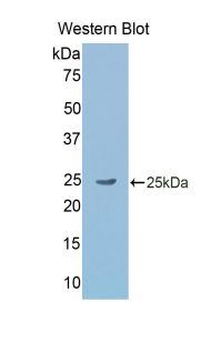 Monoclonal Antibody to Gastrokine 2 (GKN2)