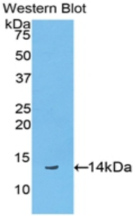 Monoclonal Antibody to Biglycan (BGN)