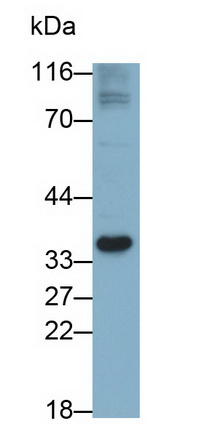 Monoclonal Antibody to Coxsackie Virus And Adenovirus Receptor (CXADR)