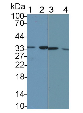 Monoclonal Antibody to Calponin 2 (CNN2)
