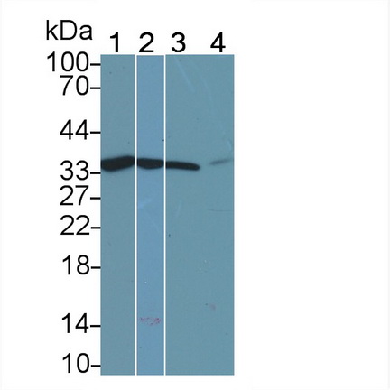 Monoclonal Antibody to Calponin 2 (CNN2)