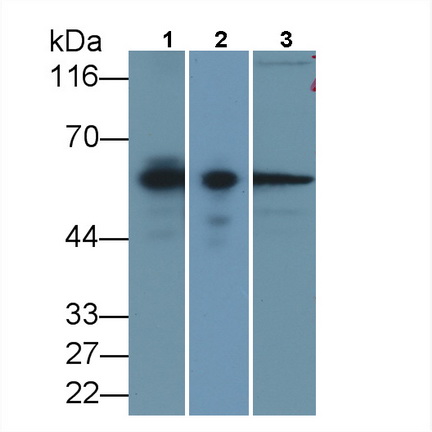 Monoclonal Antibody to Calponin 2 (CNN2)