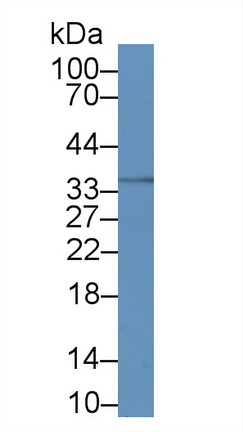 Monoclonal Antibody to Calponin 2 (CNN2)