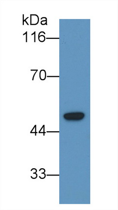 Monoclonal Antibody to Lecithin Cholesterol Acyltransferase (LCAT)