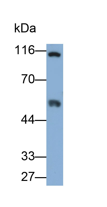 Monoclonal Antibody to Lecithin Cholesterol Acyltransferase (LCAT)