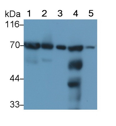 Monoclonal Antibody to Succinate Dehydrogenase Complex Subunit A (SDHA)