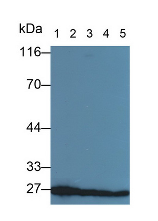 Monoclonal Antibody to Tyrosine 3/Tryptophan 5 Monooxygenase Activation Protein Zeta (YWHAz)