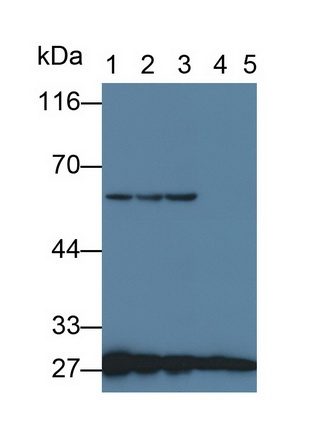 Monoclonal Antibody to Tyrosine 3/Tryptophan 5 Monooxygenase Activation Protein Zeta (YWHAz)