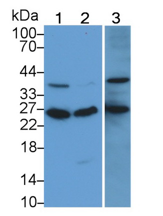 Monoclonal Antibody to RAB5A, Member RAS Oncogene Family (RAB5A)