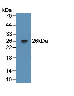 Monoclonal Antibody to Pentraxin 3, Long (PTX3)