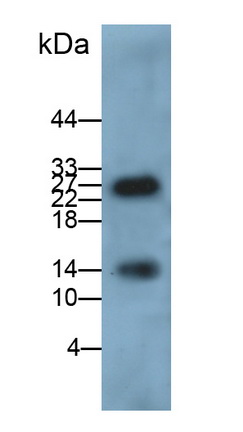 Monoclonal Antibody to Calprotectin (CALPRO)