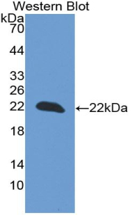 Monoclonal Antibody to Parkinson Disease Protein 7 (PARK7)