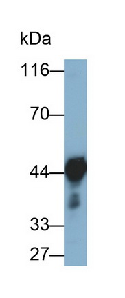 Monoclonal Antibody to Alpha-2-Glycoprotein 1, Zinc Binding (aZGP1)