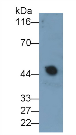 Monoclonal Antibody to Alpha-2-Glycoprotein 1, Zinc Binding (aZGP1)