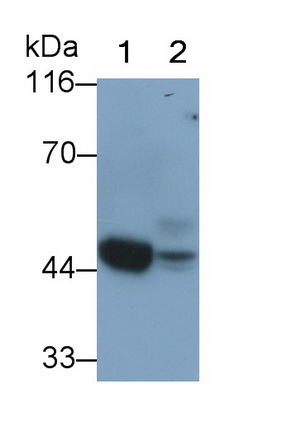 Monoclonal Antibody to Alpha-2-Glycoprotein 1, Zinc Binding (aZGP1)