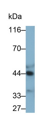 Monoclonal Antibody to Alpha-2-Glycoprotein 1, Zinc Binding (aZGP1)