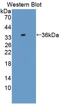 Monoclonal Antibody to Alpha-2-Glycoprotein 1, Zinc Binding (aZGP1)