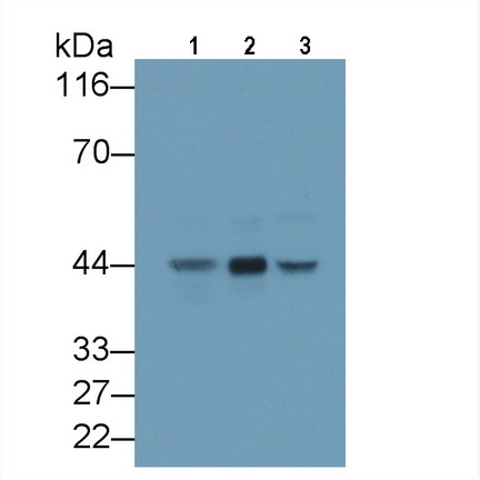 Monoclonal Antibody to Alpha-2-Glycoprotein 1, Zinc Binding (aZGP1)