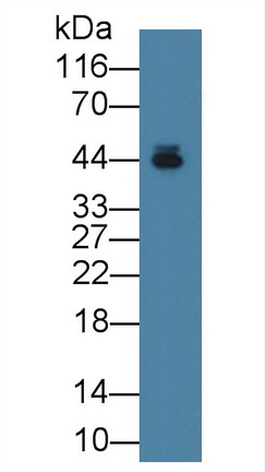 Monoclonal Antibody to Alpha-2-Glycoprotein 1, Zinc Binding (aZGP1)