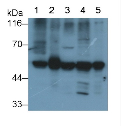 Monoclonal Antibody to Chaperonin Containing TCP1, Subunit 2 (CCT2)