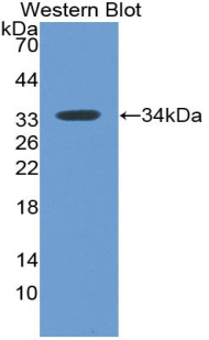 Monoclonal Antibody to Myxovirus Resistance 1 (MX1)