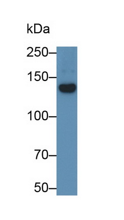 Monoclonal Antibody to Semaphorin 5A (SEMA5A)