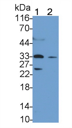 Monoclonal Antibody to T-Cell Immunoreceptor With Ig And ITIM Domains Protein (TIGIT)