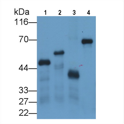 Monoclonal Antibody to Glutathione S Transferase (GST)