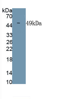 Monoclonal Antibody to Chikungunya Virus (CHIKV)