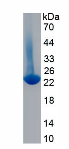 Native C Reactive Protein (CRP)