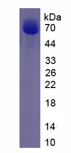 Native Albumin (ALB)