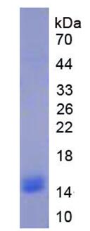 Native Hemoglobin (HB)