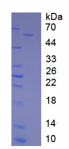 Native Catalase (CAT)