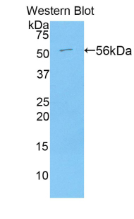 Polyclonal Antibody to Angiotensin I Converting Enzyme (ACE)