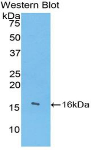 Polyclonal Antibody to Angiogenin (ANG)