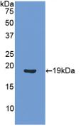 Polyclonal Antibody to Angiopoietin 1 (ANGPT1)