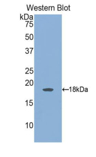 Polyclonal Antibody to Angiopoietin 2 (ANGPT2)