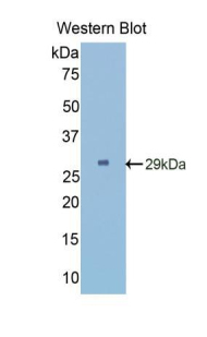 Polyclonal Antibody to Angiopoietin 2 (ANGPT2)