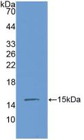 Polyclonal Antibody to Connective Tissue Growth Factor (CTGF)